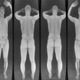Image for article titled It's Shockingly Easy to Hide Guns and Bombs From Backscatter Scanners